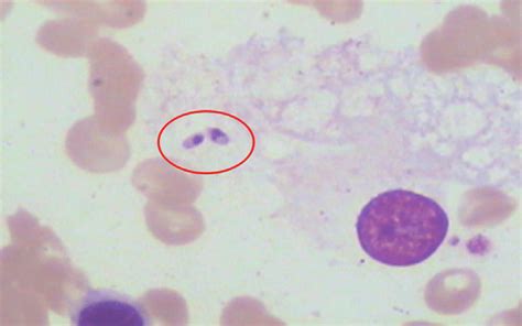  Leishmania: Bir Kan Paraziti mi Yoksa Küçük Bir Şeytan mı?