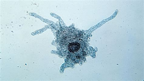 Weaver Amoeba: Discover Its Fascinating World of Pseudopodal Movement and Microscopic Feasting!